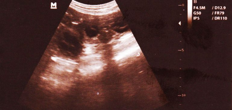 Funstuff H-Litter, puppies expected