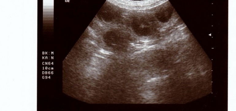 Funstuff D-Litter, Oona is expecting puppies!