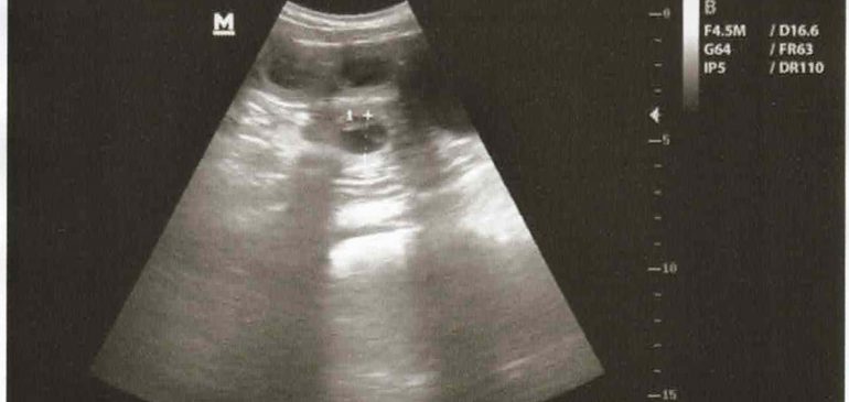 Funstuff J-litter – puppies expected!
