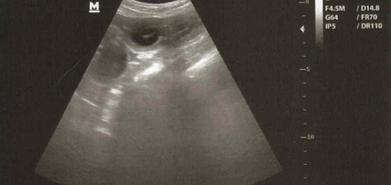 Funstuff K-litter, we are expecting puppies