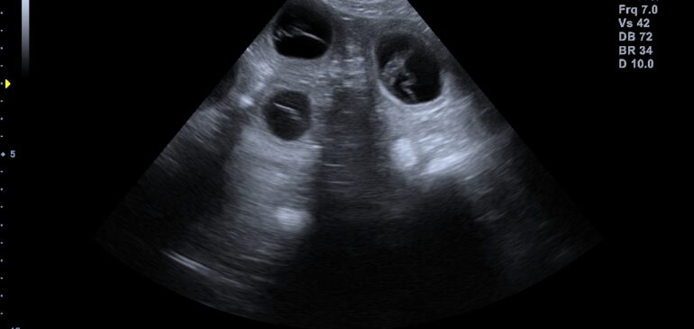 Funstuff M-Litter – we are exprecting puppies